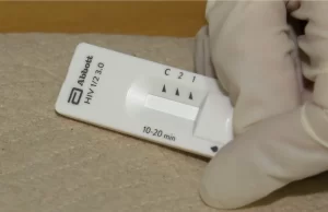 Pruebas rápidas de detección de VIH, este viernes en el HUV por el Día Mundial de la Lucha contra el Sida