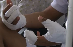 ‘Cero pólvora’, es el llamado de expertos en salud para evitar lesiones en la celebración de Noche de Velitas