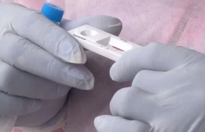 Gobierno del Valle entrega pruebas de antígeno para detectar el dengue