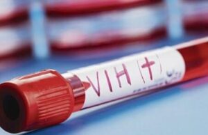 Un importante avance en la lucha contra el VIH: Descubren tratamiento prometedor para erradicar el virus del organismo