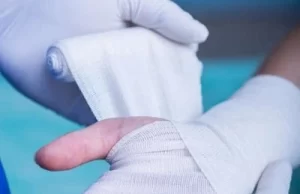 Durante la Noche de Velitas El Valle del Cauca reportó una reducción del 41,6% en personas quemadas